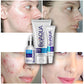 Kit Anti Acne Bioaqua