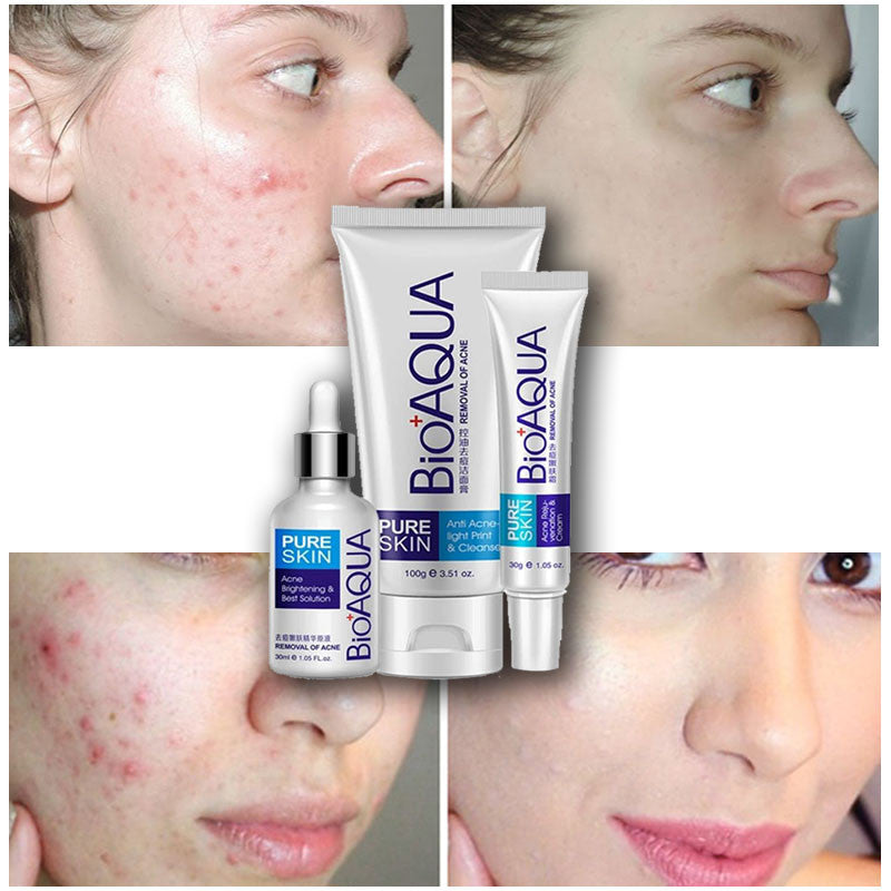 Kit Anti Acne Bioaqua